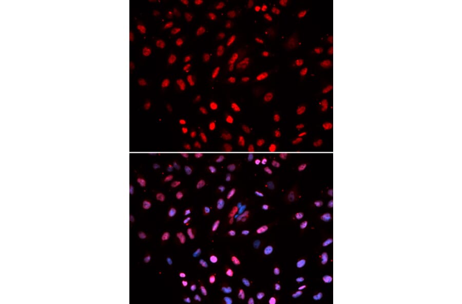 Immunofluorescence - Anti-POLD1 Antibody (A14670) - Antibodies.com