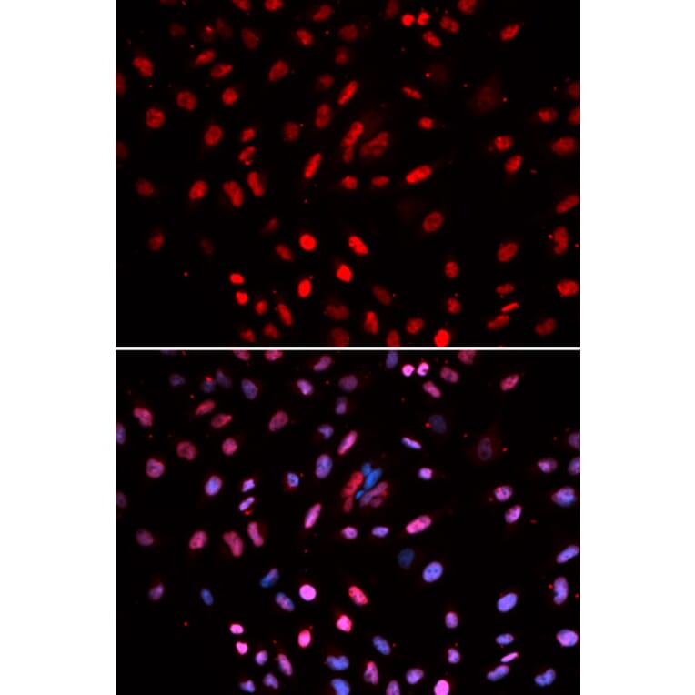 Immunofluorescence - Anti-POLD1 Antibody (A14670) - Antibodies.com