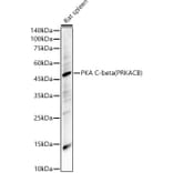 Western Blot - Anti-PKA beta (catalytic subunit) Antibody (A14671) - Antibodies.com
