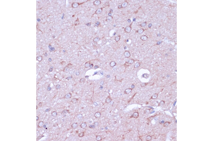 Immunohistochemistry - Anti-PKA beta (catalytic subunit) Antibody (A14671) - Antibodies.com