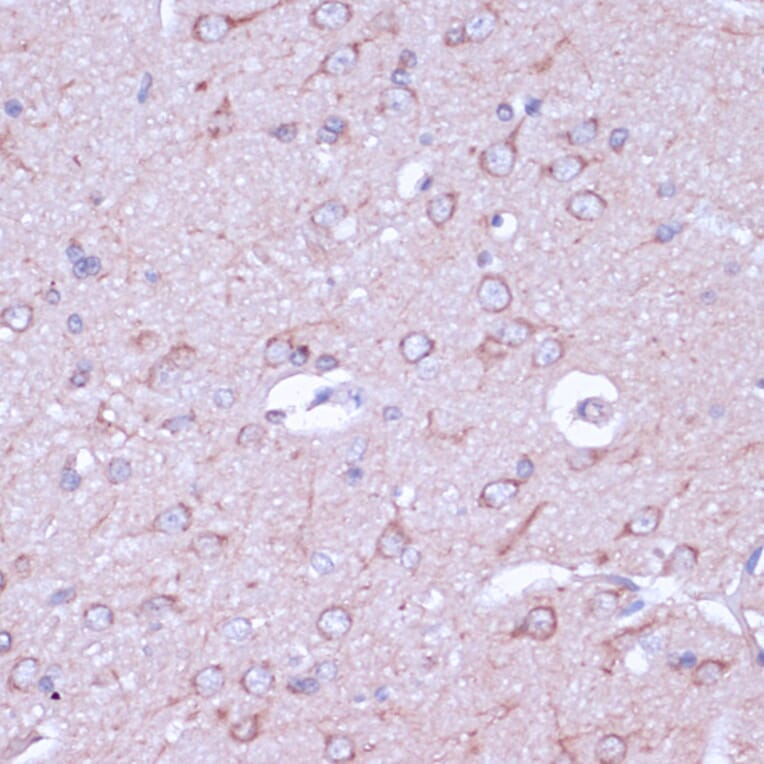 Immunohistochemistry - Anti-PKA beta (catalytic subunit) Antibody (A14671) - Antibodies.com