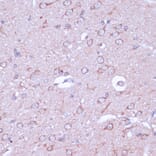 Immunohistochemistry - Anti-PKA beta (catalytic subunit) Antibody (A14671) - Antibodies.com
