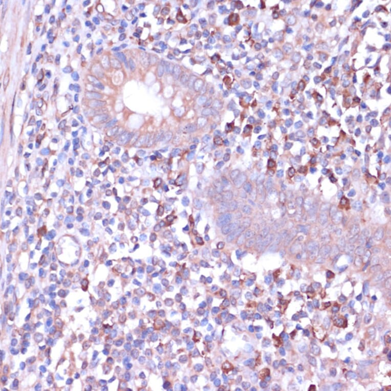 Immunohistochemistry - Anti-PKA beta (catalytic subunit) Antibody (A14671) - Antibodies.com