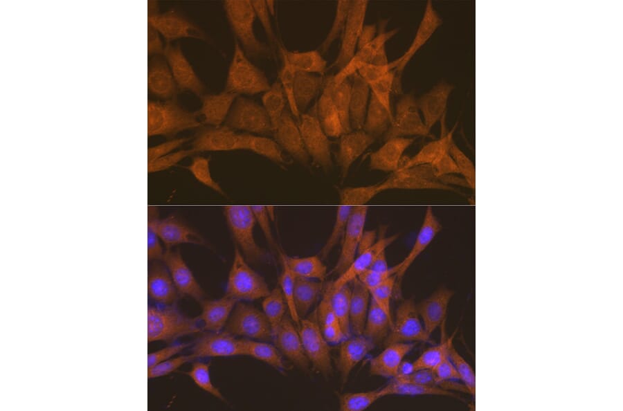 Immunofluorescence - Anti-PKA beta (catalytic subunit) Antibody (A14671) - Antibodies.com