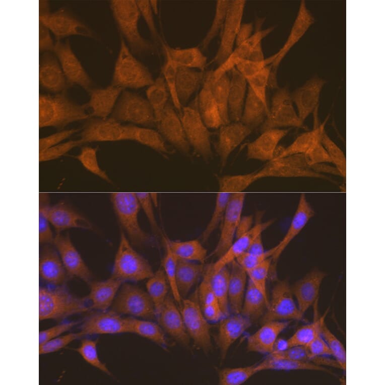 Immunofluorescence - Anti-PKA beta (catalytic subunit) Antibody (A14671) - Antibodies.com