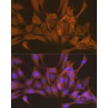 Immunofluorescence - Anti-PKA beta (catalytic subunit) Antibody (A14671) - Antibodies.com