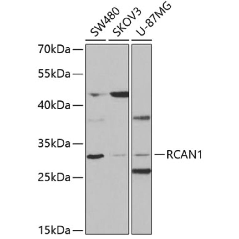 Western Blot - Anti-Calcipressin 1/RCAN1 Antibody (A14673) - Antibodies.com