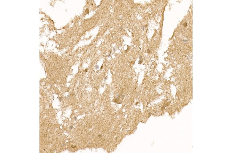 Immunohistochemistry - Anti-Calcipressin 1/RCAN1 Antibody (A14673) - Antibodies.com