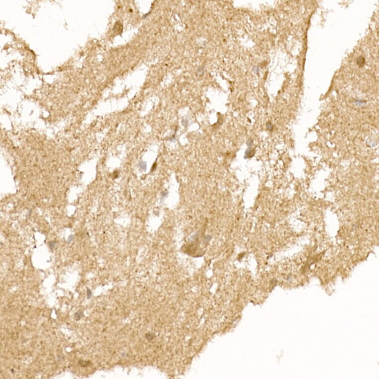 Immunohistochemistry - Anti-Calcipressin 1/RCAN1 Antibody (A14673) - Antibodies.com