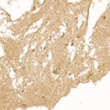 Immunohistochemistry - Anti-Calcipressin 1/RCAN1 Antibody (A14673) - Antibodies.com