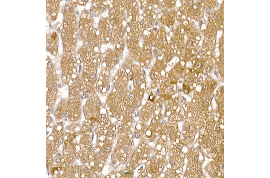 Immunohistochemistry - Anti-Calcipressin 1/RCAN1 Antibody (A14673) - Antibodies.com