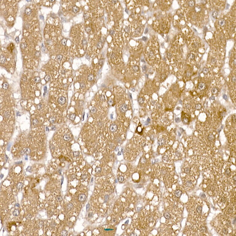 Immunohistochemistry - Anti-Calcipressin 1/RCAN1 Antibody (A14673) - Antibodies.com
