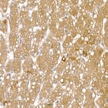 Immunohistochemistry - Anti-Calcipressin 1/RCAN1 Antibody (A14673) - Antibodies.com