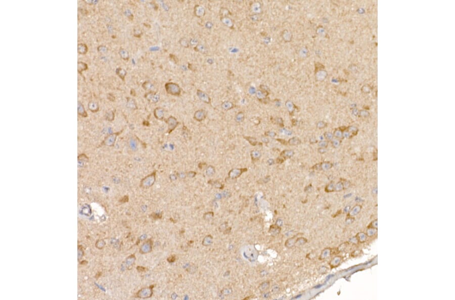 Immunohistochemistry - Anti-Calcipressin 1/RCAN1 Antibody (A14673) - Antibodies.com