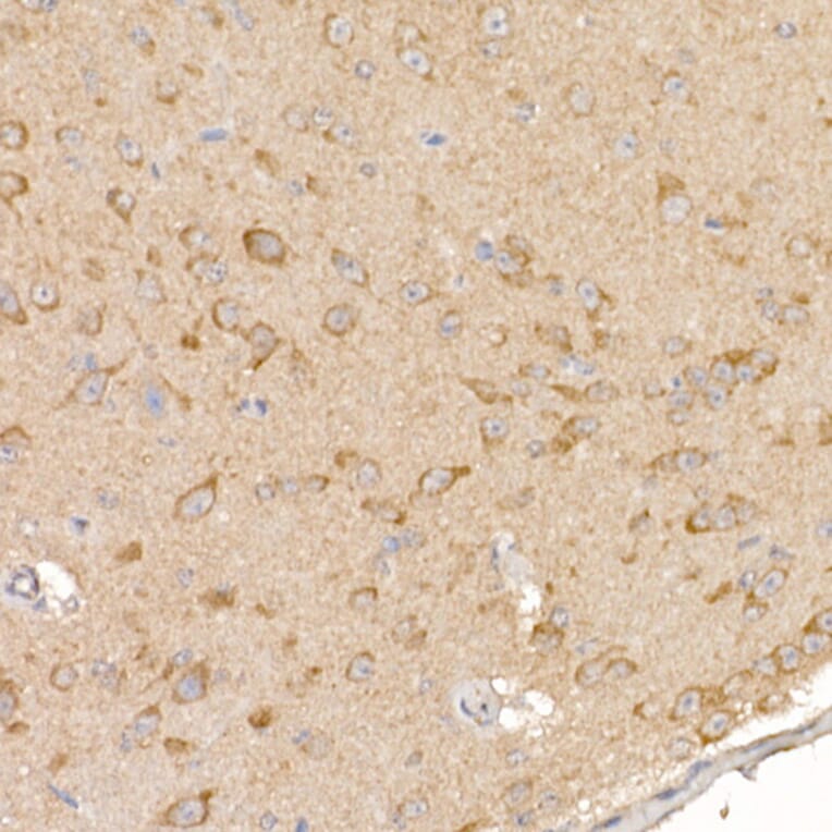 Immunohistochemistry - Anti-Calcipressin 1/RCAN1 Antibody (A14673) - Antibodies.com