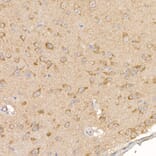 Immunohistochemistry - Anti-Calcipressin 1/RCAN1 Antibody (A14673) - Antibodies.com