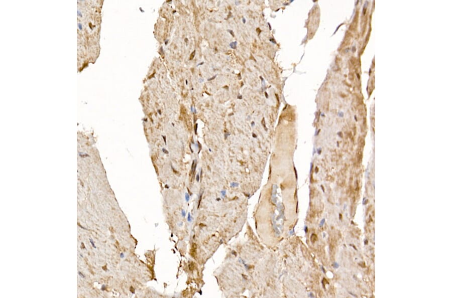 Immunohistochemistry - Anti-Calcipressin 1/RCAN1 Antibody (A14673) - Antibodies.com