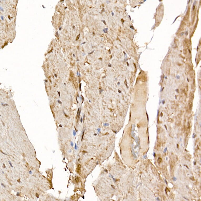 Immunohistochemistry - Anti-Calcipressin 1/RCAN1 Antibody (A14673) - Antibodies.com