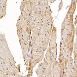 Immunohistochemistry - Anti-Calcipressin 1/RCAN1 Antibody (A14673) - Antibodies.com