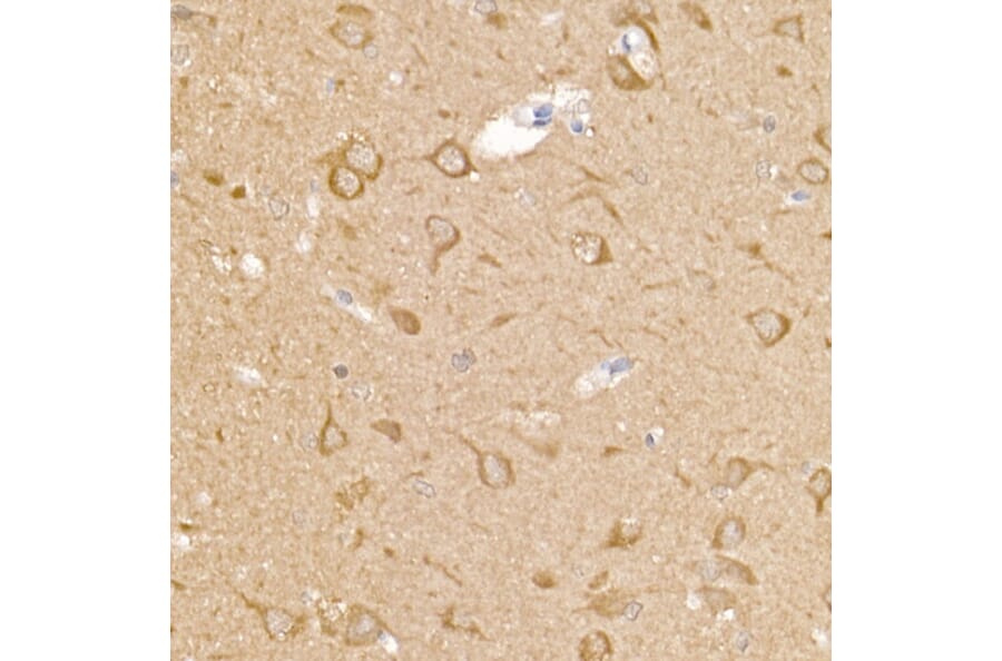 Immunohistochemistry - Anti-Calcipressin 1/RCAN1 Antibody (A14673) - Antibodies.com