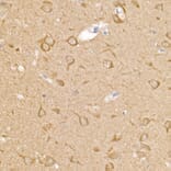 Immunohistochemistry - Anti-Calcipressin 1/RCAN1 Antibody (A14673) - Antibodies.com