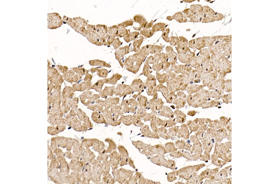 Immunohistochemistry - Anti-Calcipressin 1/RCAN1 Antibody (A14673) - Antibodies.com