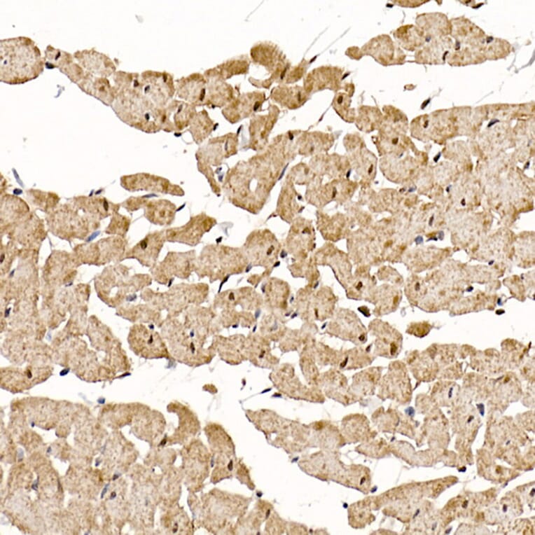 Immunohistochemistry - Anti-Calcipressin 1/RCAN1 Antibody (A14673) - Antibodies.com