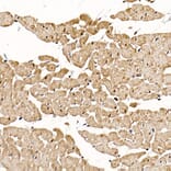 Immunohistochemistry - Anti-Calcipressin 1/RCAN1 Antibody (A14673) - Antibodies.com