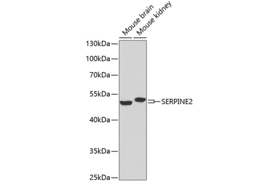 Western Blot - Anti-SERPINE2/PN-1 Antibody (A14674) - Antibodies.com