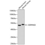 Western Blot - Anti-SERPINE2/PN-1 Antibody (A14674) - Antibodies.com