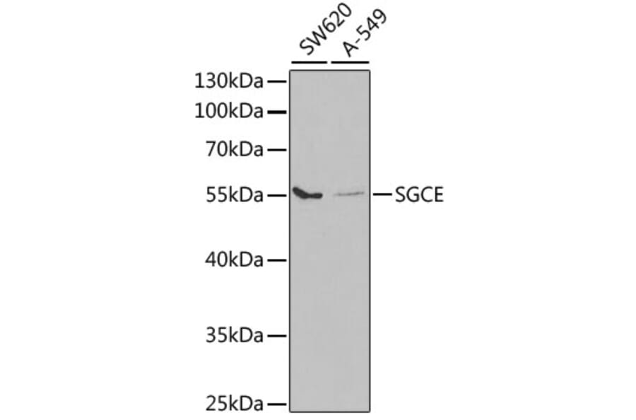 Western Blot - Anti-SGCE/ESG Antibody (A14675) - Antibodies.com