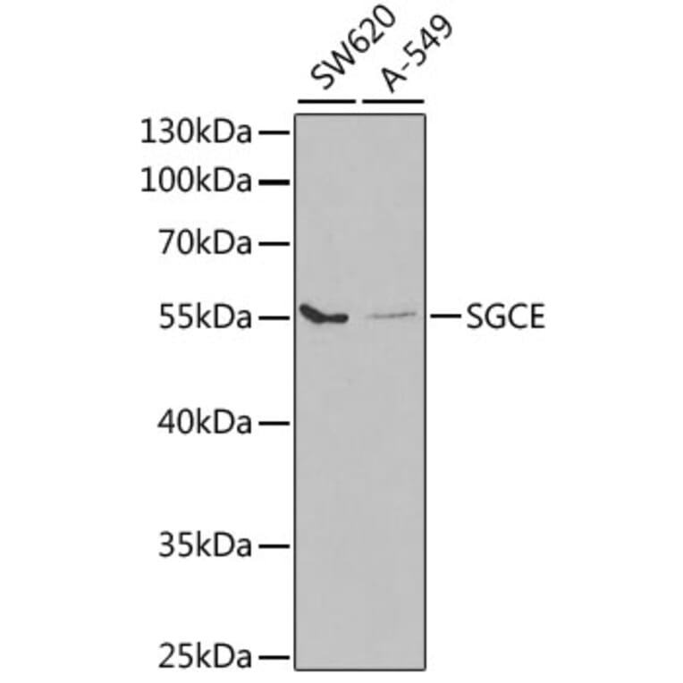 Western Blot - Anti-SGCE/ESG Antibody (A14675) - Antibodies.com