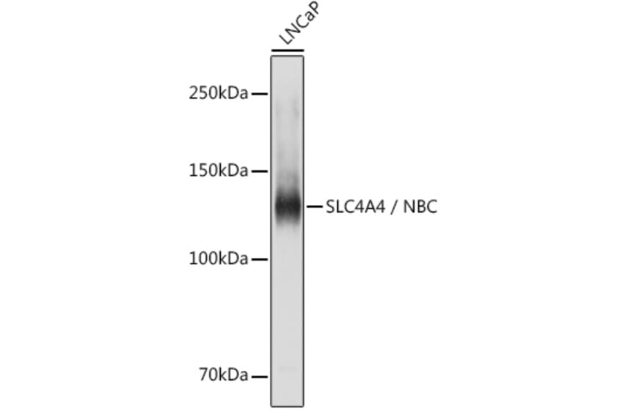 Western Blot - Anti-SLC4A4/NBC Antibody (A14677) - Antibodies.com