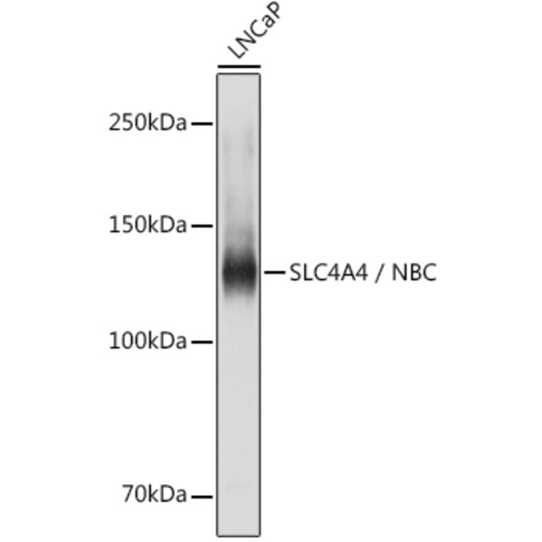 Western Blot - Anti-SLC4A4/NBC Antibody (A14677) - Antibodies.com