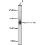 Western Blot - Anti-SLC4A4/NBC Antibody (A14677) - Antibodies.com