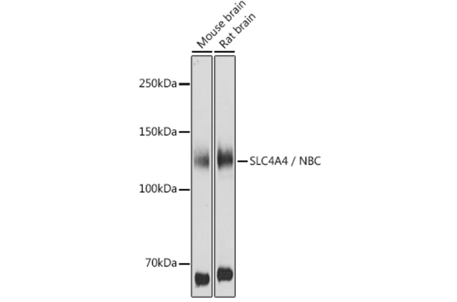Western Blot - Anti-SLC4A4/NBC Antibody (A14677) - Antibodies.com