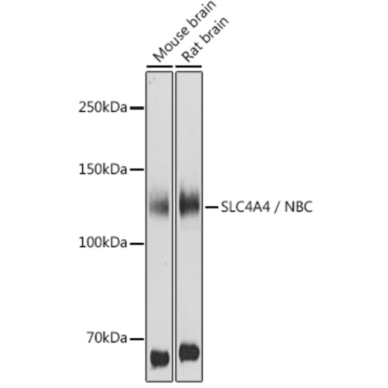 Western Blot - Anti-SLC4A4/NBC Antibody (A14677) - Antibodies.com