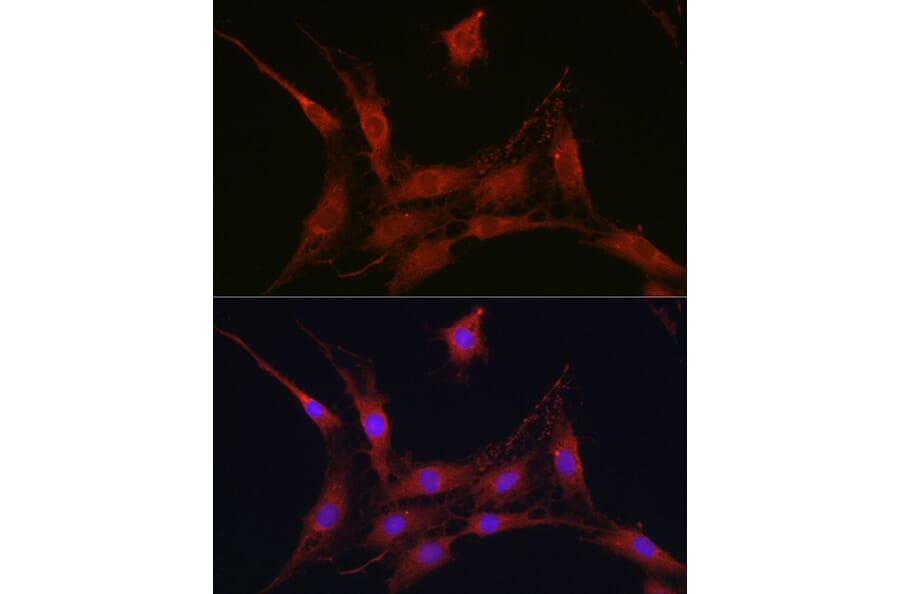 Immunofluorescence - Anti-SLC4A4/NBC Antibody (A14677) - Antibodies.com