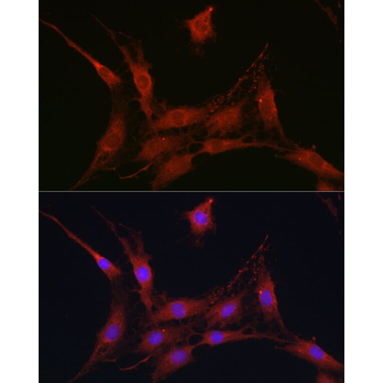 Immunofluorescence - Anti-SLC4A4/NBC Antibody (A14677) - Antibodies.com