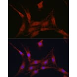 Immunofluorescence - Anti-SLC4A4/NBC Antibody (A14677) - Antibodies.com