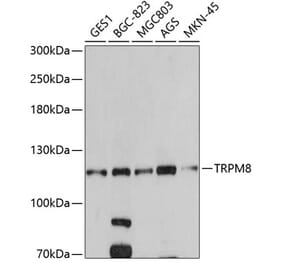 Western Blot - Anti-TRPM8 Antibody (A14678) - Antibodies.com