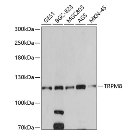 Western Blot - Anti-TRPM8 Antibody (A14678) - Antibodies.com