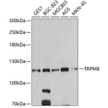 Western Blot - Anti-TRPM8 Antibody (A14678) - Antibodies.com