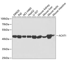 Western Blot - Anti-ACAT1 Antibody (A5335) - Antibodies.com