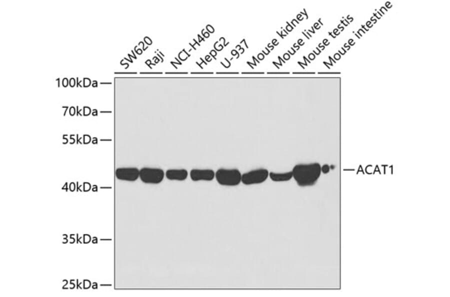 Western Blot - Anti-ACAT1 Antibody (A5335) - Antibodies.com