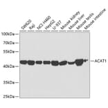 Western Blot - Anti-ACAT1 Antibody (A5335) - Antibodies.com