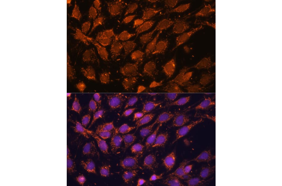 Immunofluorescence - Anti-ACAT1 Antibody (A5335) - Antibodies.com