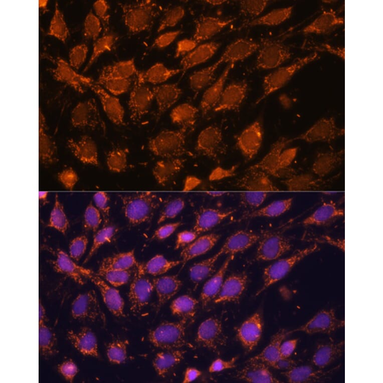 Immunofluorescence - Anti-ACAT1 Antibody (A5335) - Antibodies.com