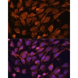 Immunofluorescence - Anti-ACAT1 Antibody (A5335) - Antibodies.com
