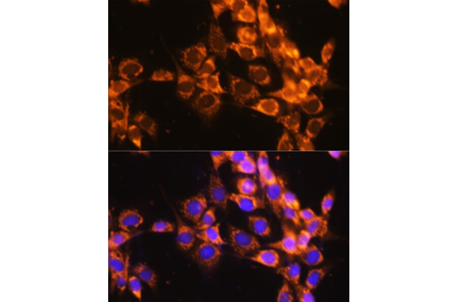 Immunofluorescence - Anti-ACAT1 Antibody (A5335) - Antibodies.com
